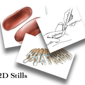 2D Medical Illustration - Still Image